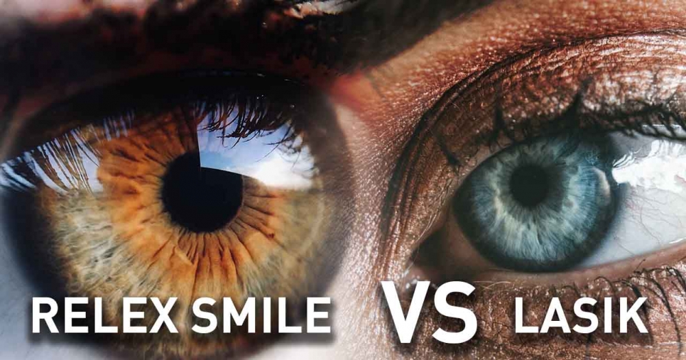 Relex Smile vs ILasik